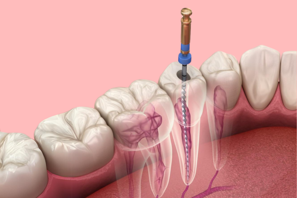 Dental Clinic Near Whitefield